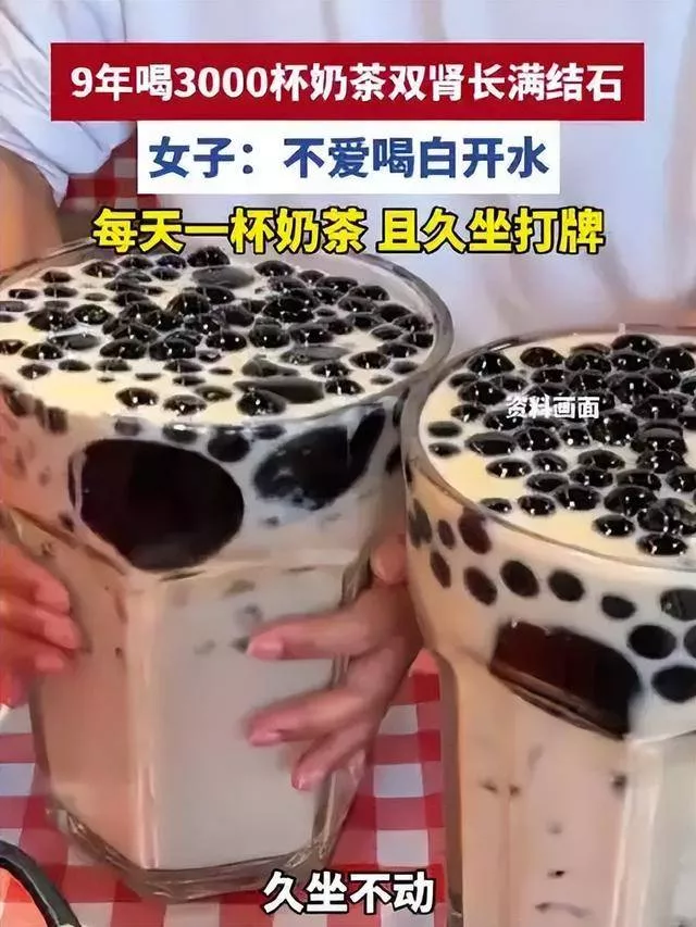 长沙女子9年狂喝3000杯奶茶，肾脏被结石塞满